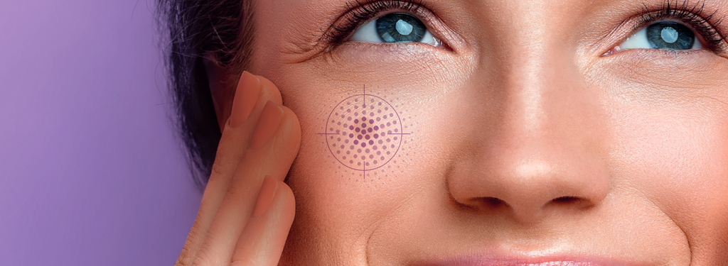 Beauty routine anti-macchie per il viso: trattamenti e consigli